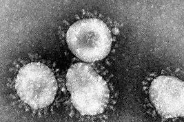 A2.3 Viruses - exam practice